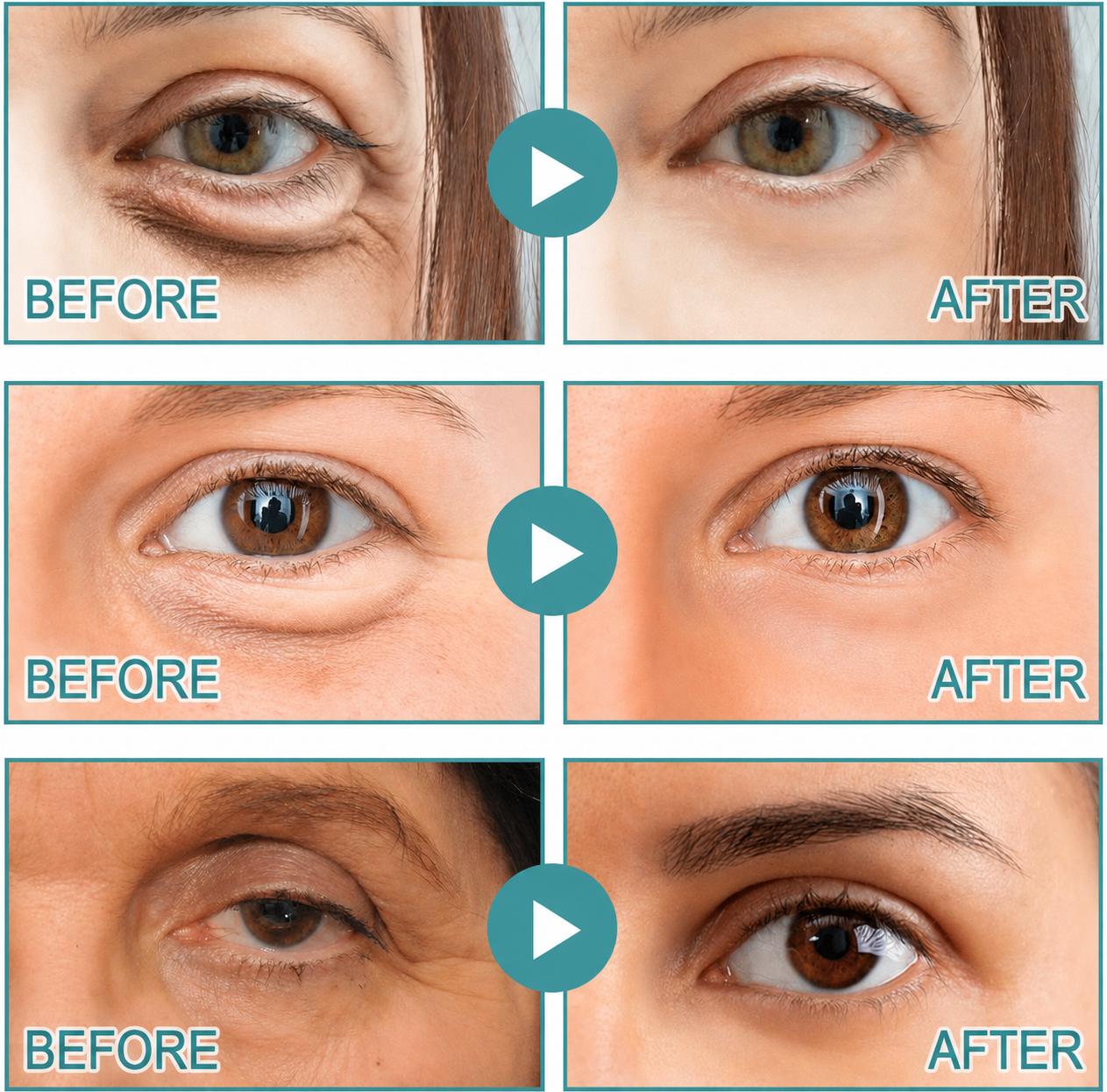 Flohpath | Dissolving Microneedle Eye Patches