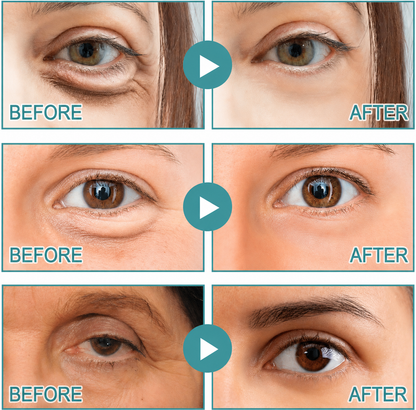Flohpath | Dissolving Microneedle Eye Patches